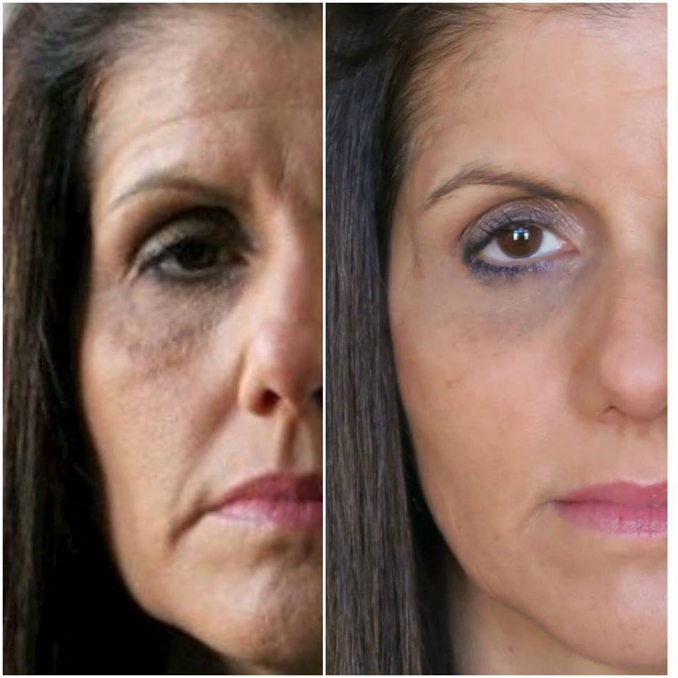 instant-youth-before-after-3 instant-youth-before-after-3