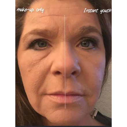 instant-youth-compare-1 instant-youth-compare-1